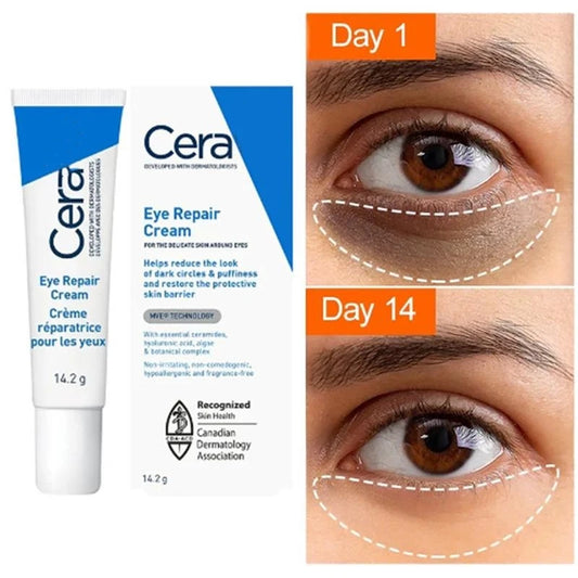 Retinol Eye Cream Remover Dark Circles